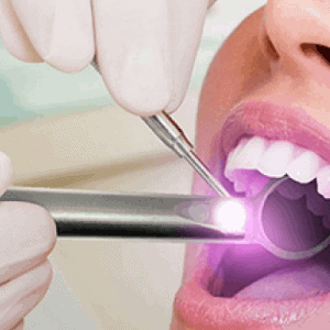 Using dental equipment and a mini torch, a dentist examines a patient's teeth
