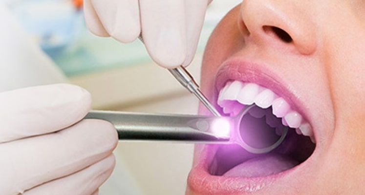 Dentist checking a patient's oral cancer symptoms