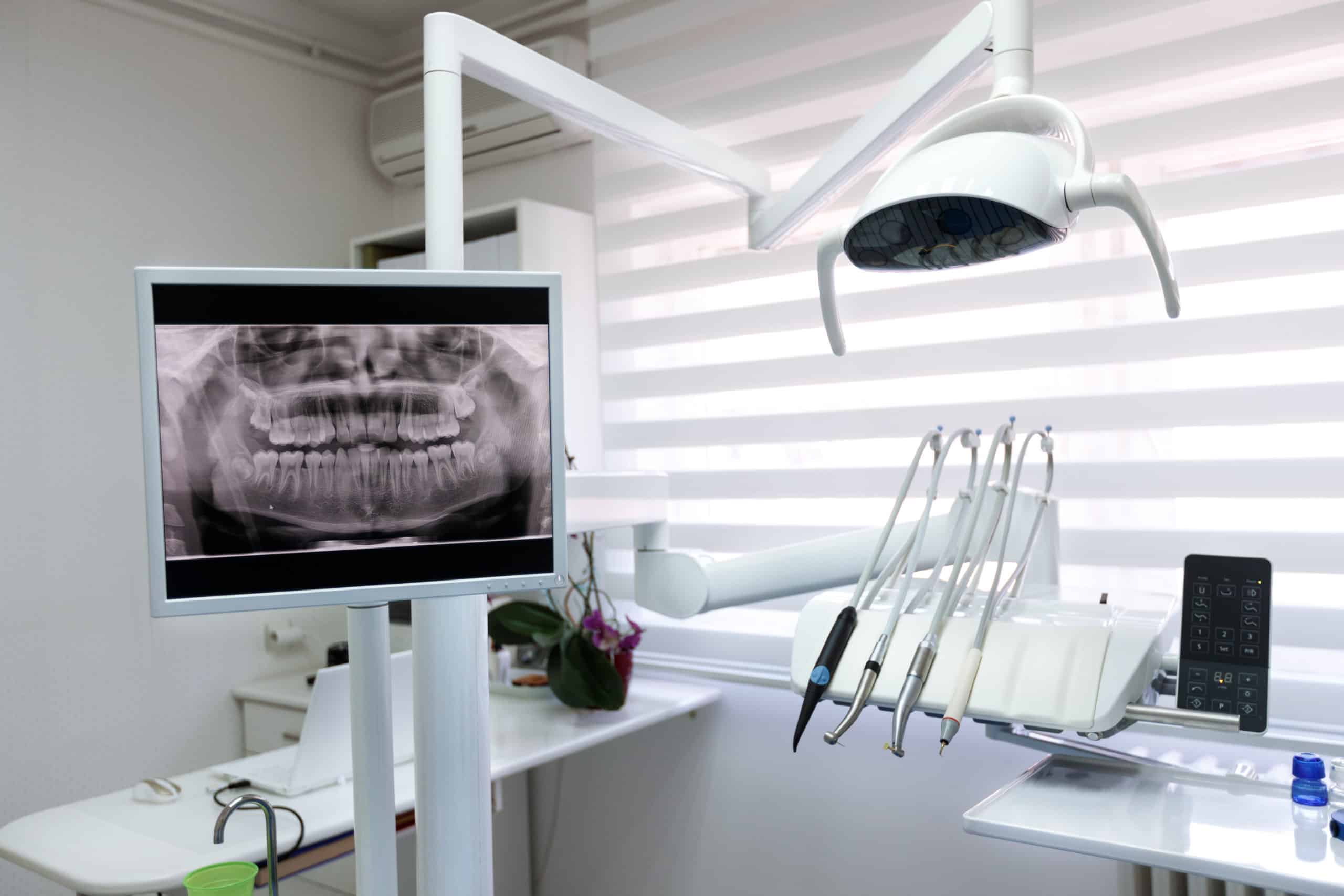 Digital x-ray displayed in the advanced technology dental clinic in medavakkam