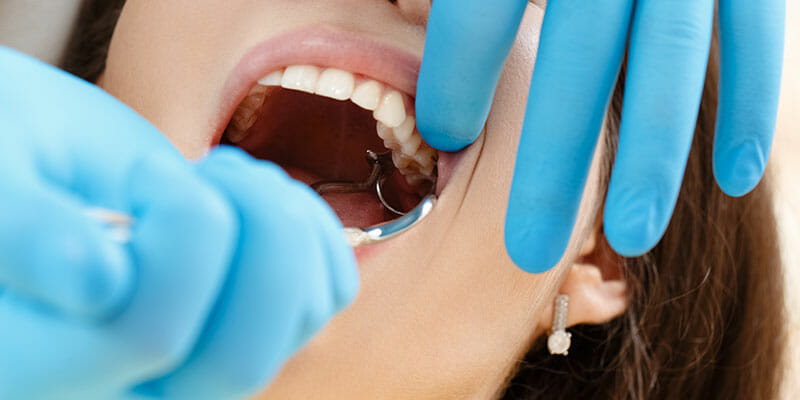 A dentist is doing a wisdom teeth removal surgery for a woman using forceps.