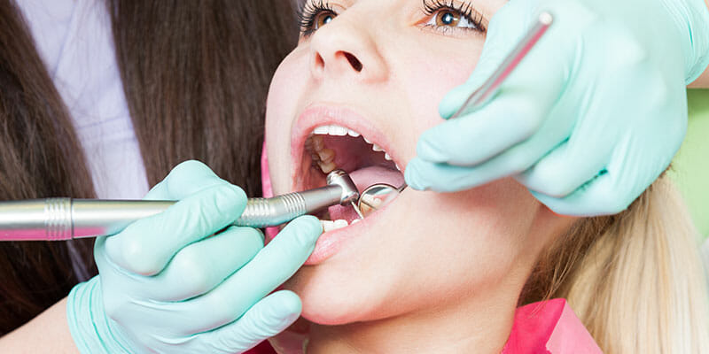A professional dentist is doing a tartar removal treatment for a woman with forceps and portable toothpicks
